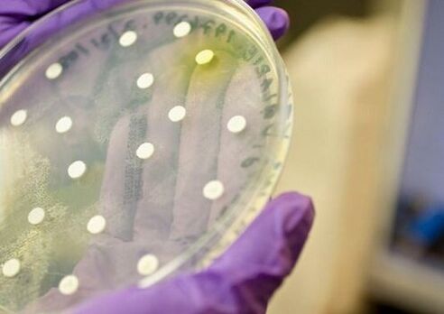 bakteriális kultúra a prosztatagyulladás diagnosztizálására